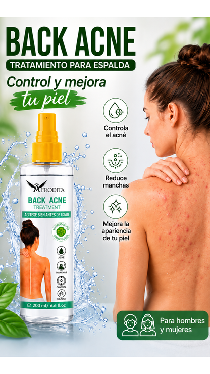 SPRAY BACK ACNE + ENVÍO GRATIS