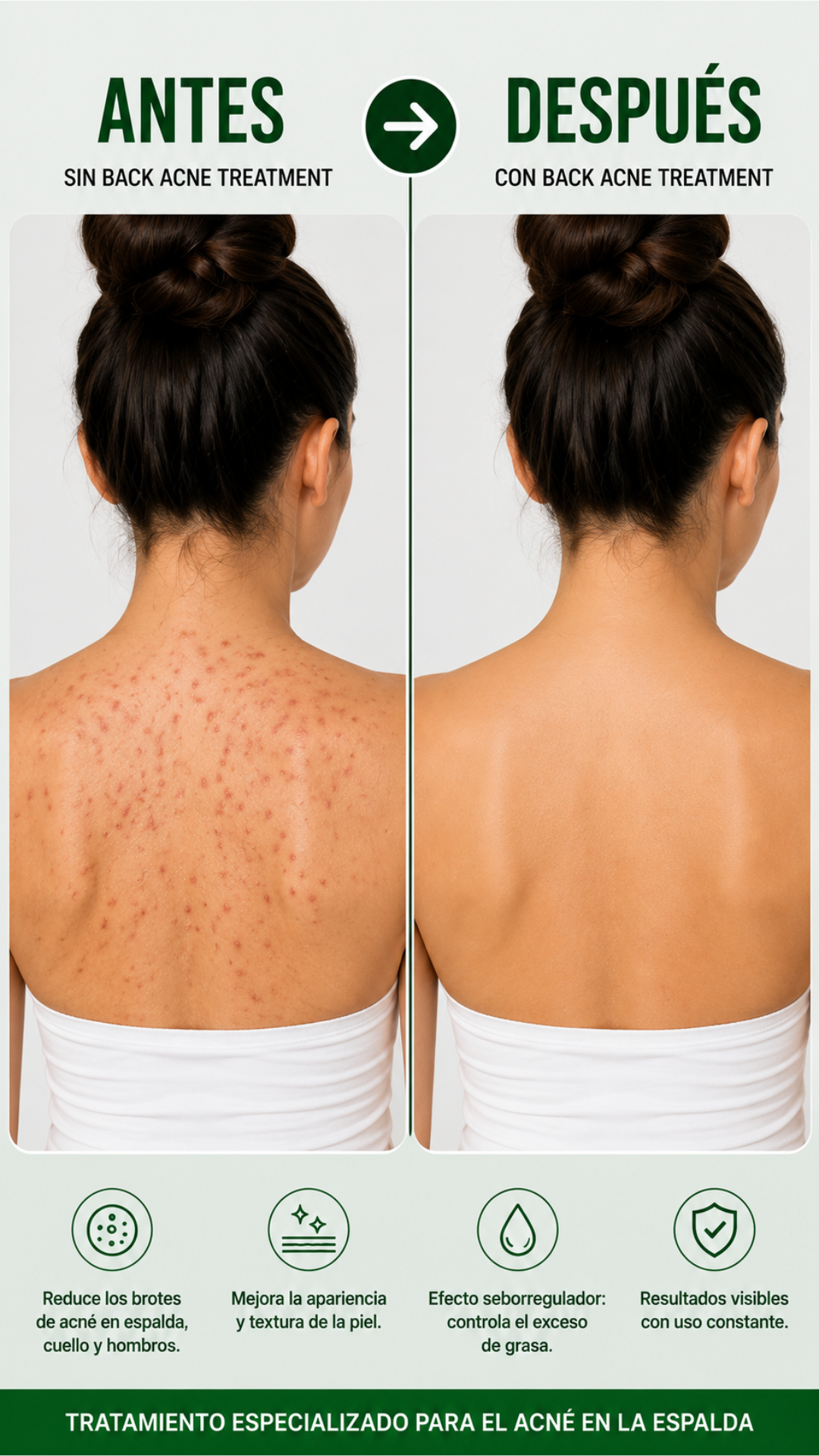 SPRAY BACK ACNE + ENVÍO GRATIS
