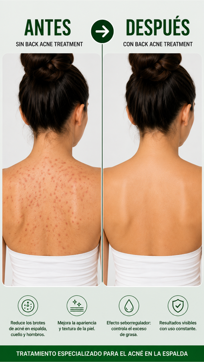 SPRAY BACK ACNE + ENVÍO GRATIS